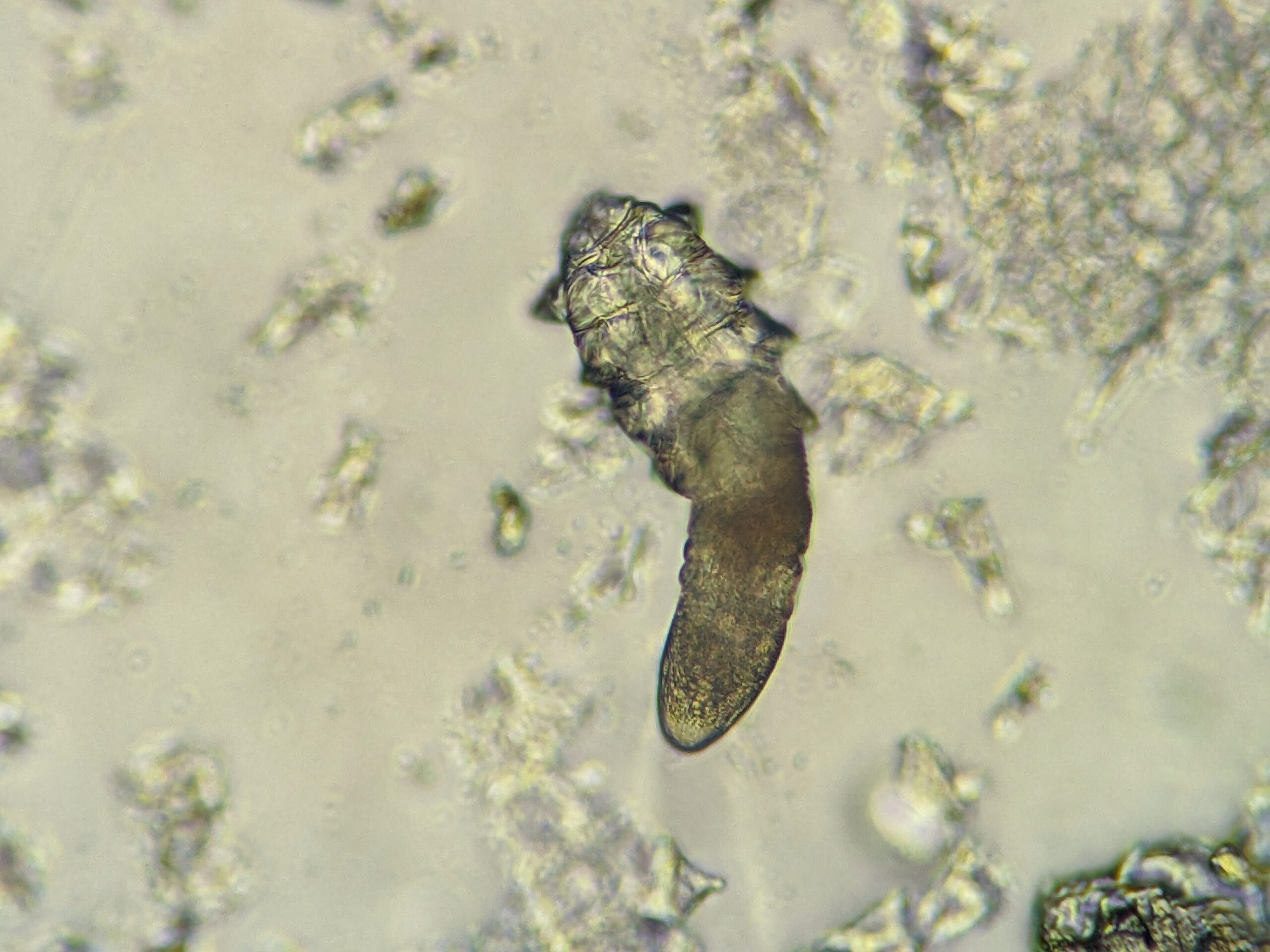 Mikroskopický záber na parazita Demodex canis